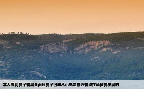 本人男我鼻子有黑头而且鼻子很油从小就是最近有点往酒糟鼻发展的