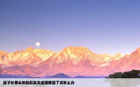 鼻子长黑头粉刺后发炎成酒糟鼻了该怎么办