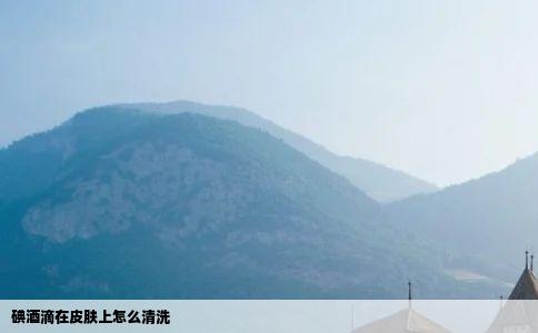 碘酒滴在皮肤上怎么清洗