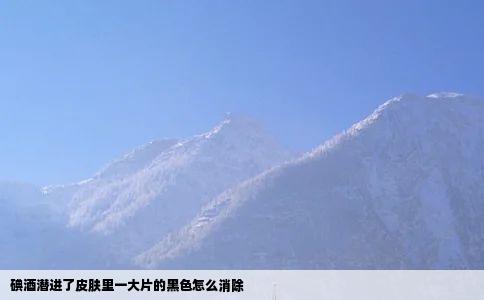 碘酒潜进了皮肤里一大片的黑色怎么消除