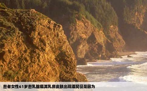 患者女性61岁患乳腺癌其乳房皮肤出现酒窝征是因为