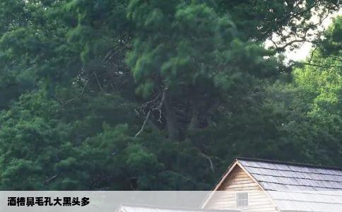 酒槽鼻毛孔大黑头多