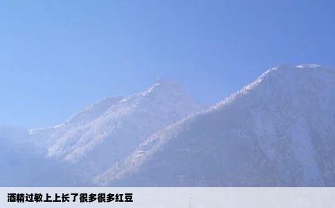 酒精过敏上上长了很多很多红豆