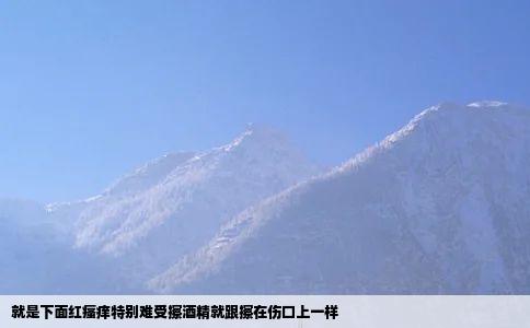 就是下面红瘙痒特别难受擦酒精就跟擦在伤口上一样