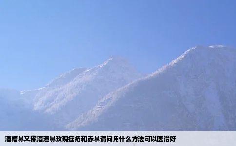 酒糟鼻又称酒渣鼻玫瑰痤疮和赤鼻请问用什么方法可以医治好