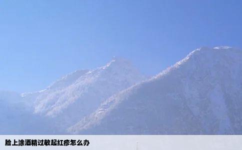 脸上涂酒精过敏起红疹怎么办