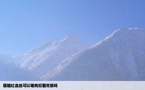 眼睛红血丝可以喝枸杞菊花茶吗